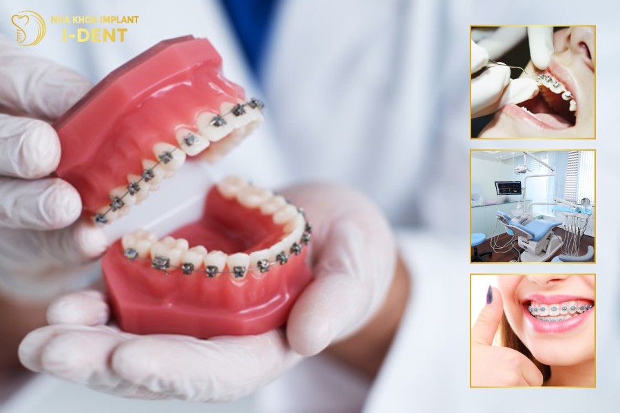 Những-tiêu-chí-chọn-địa-chỉ-niềng-răng-uy-tín