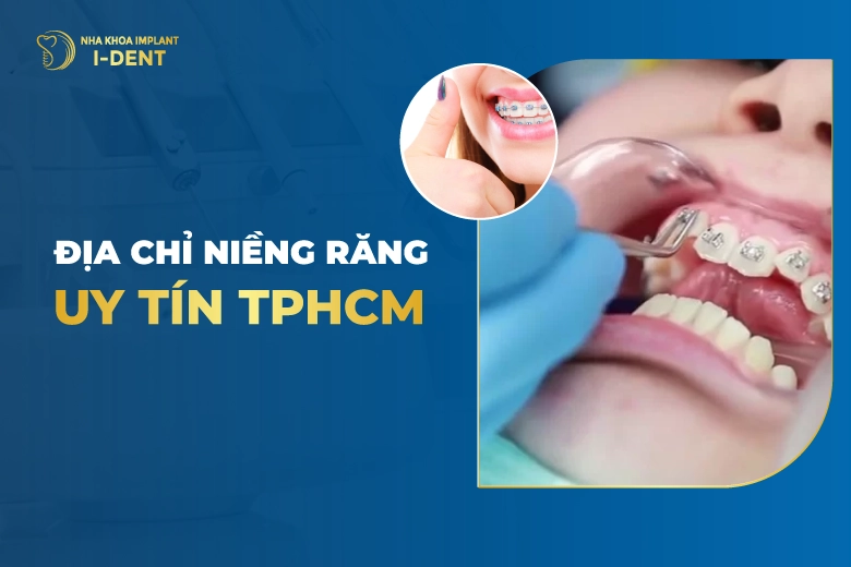 Top 10 Địa Chỉ Nha Khoa Niềng Răng Uy Tín TPHCM