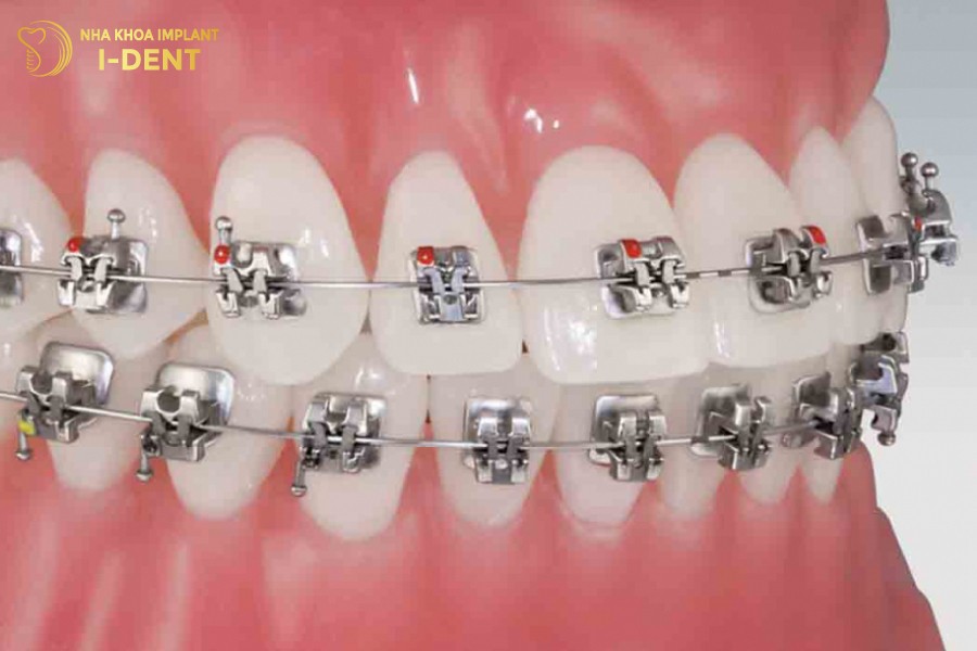 Cac-nap-truot-tu-dong-co-the-dong-mo-de-dang-giup-giu-chac-day-cai