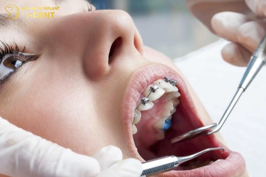 Rang-se-bat-dau-dich-chuyen-ngay-giai-doan-2-6-thang-dau-sau-khi-gan-mac-cai