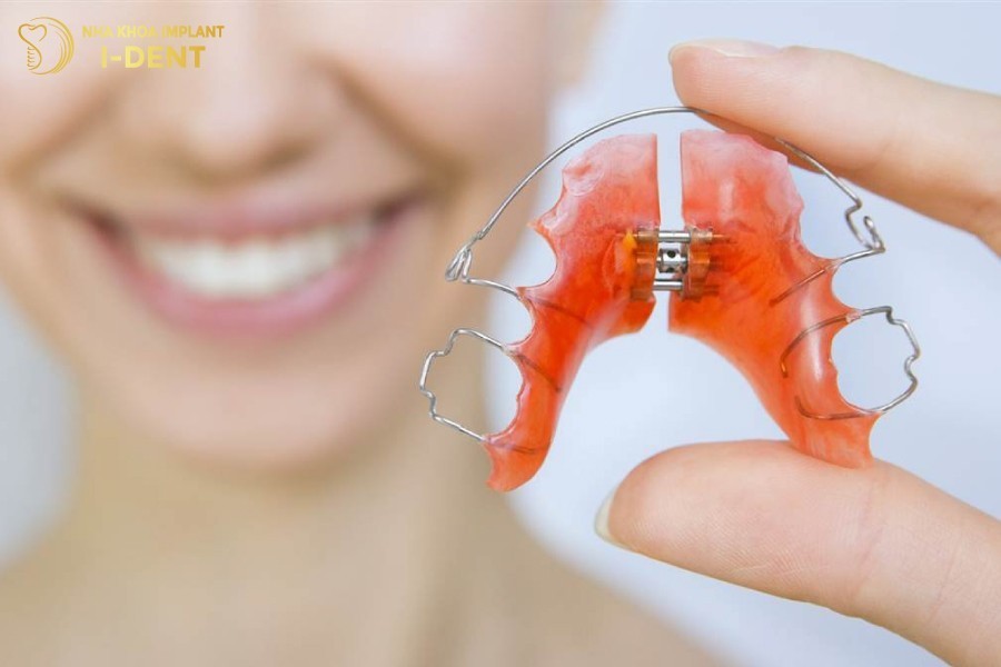 Thoi-gian-deo-ham-duy-tri-tu-6-–-12-thang