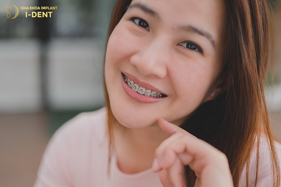 quy trình niềng răng