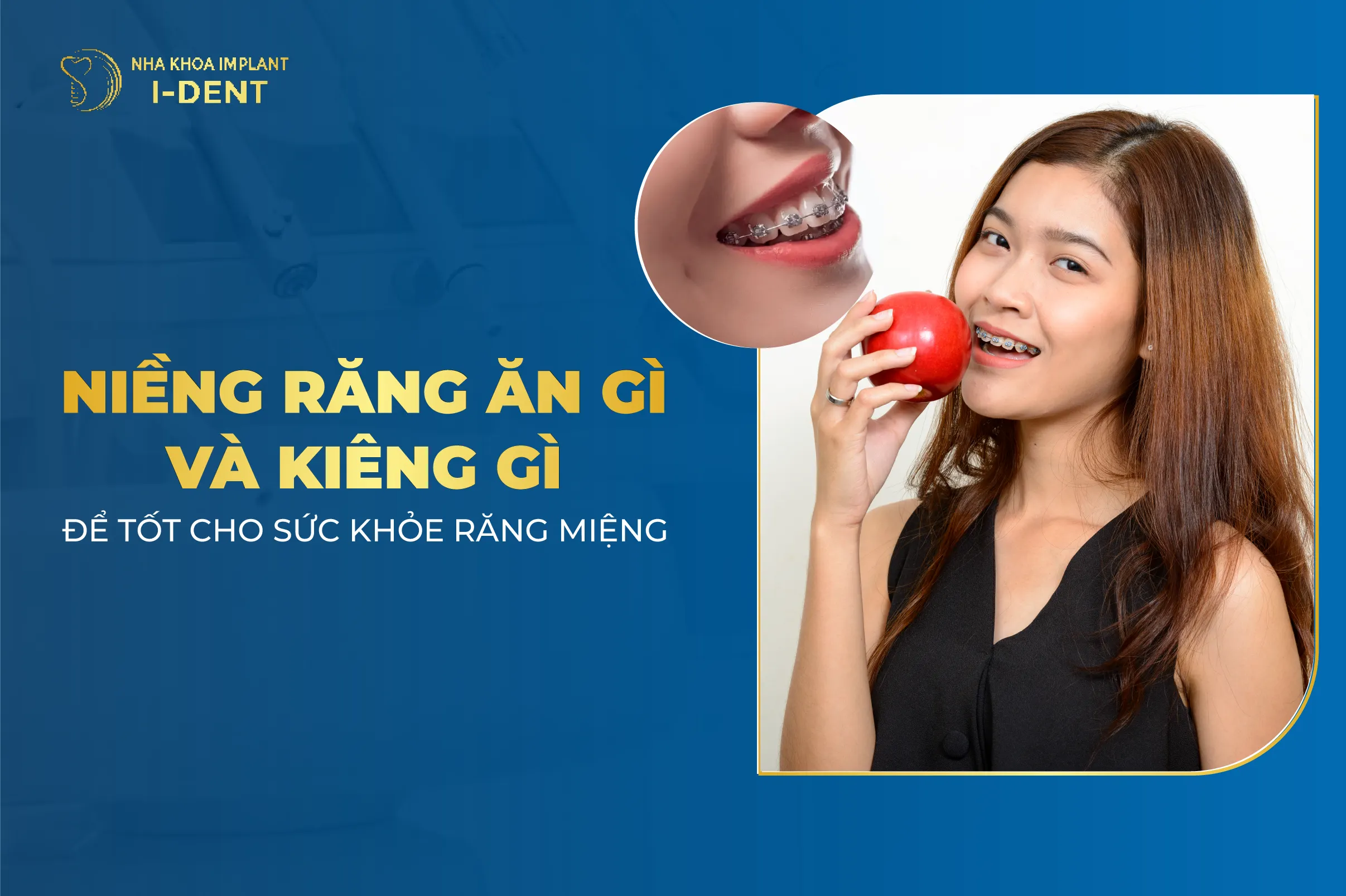 Niềng Răng Ăn Gì Và Kiêng Gì Để Tốt Cho Sức Khỏe Răng Miệng