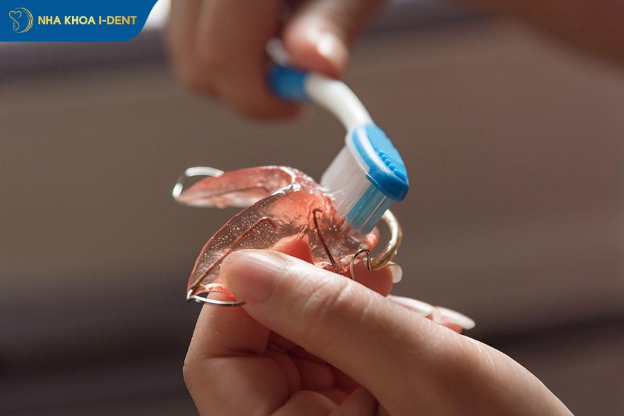 niềng răng xong phải đeo hàm duy trì bao lâu