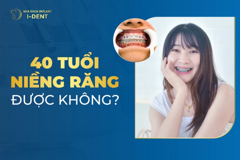 40 Tuổi Niềng Răng Được Không? Có Lâu Không?