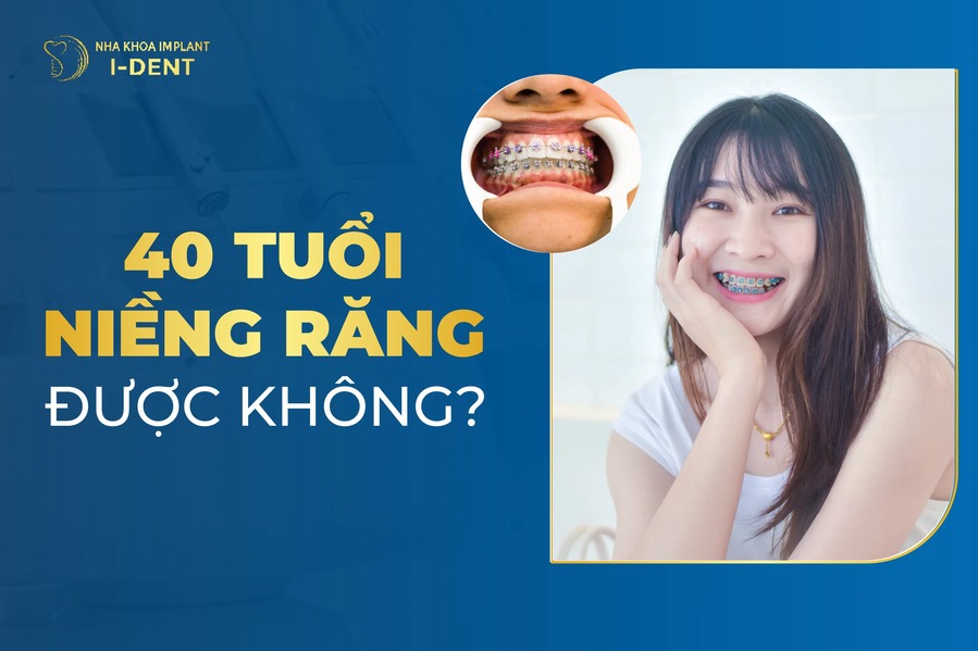 40 Tuổi Niềng Răng Được Không? Có Lâu Không?