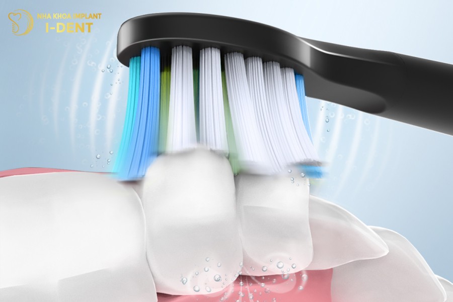 Bàn chải đánh răng điện có tốt không- Ai nên dùng-