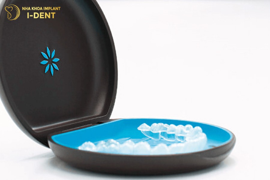 dụng cụ niềng răng tại nhà