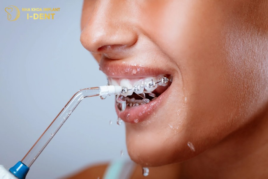 Cac-dung-cu-ve-sinh-chuyen-dung-cho-rang-nieng