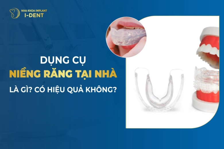 Bộ Niềng Răng Tại Nhà Là Gì? Có Hiệu Quả Không?