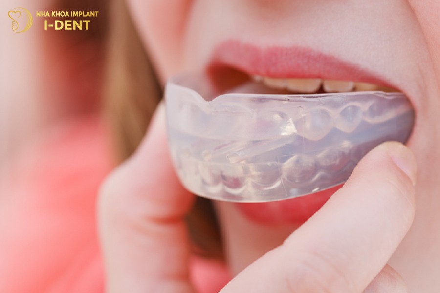 niềng răng trainer có hiệu quả không