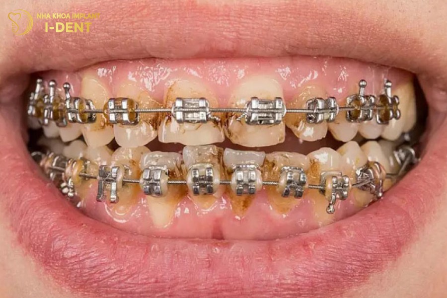 Mang-bam-de-tich-tu-va-hinh-thanh-khi-nieng-rang