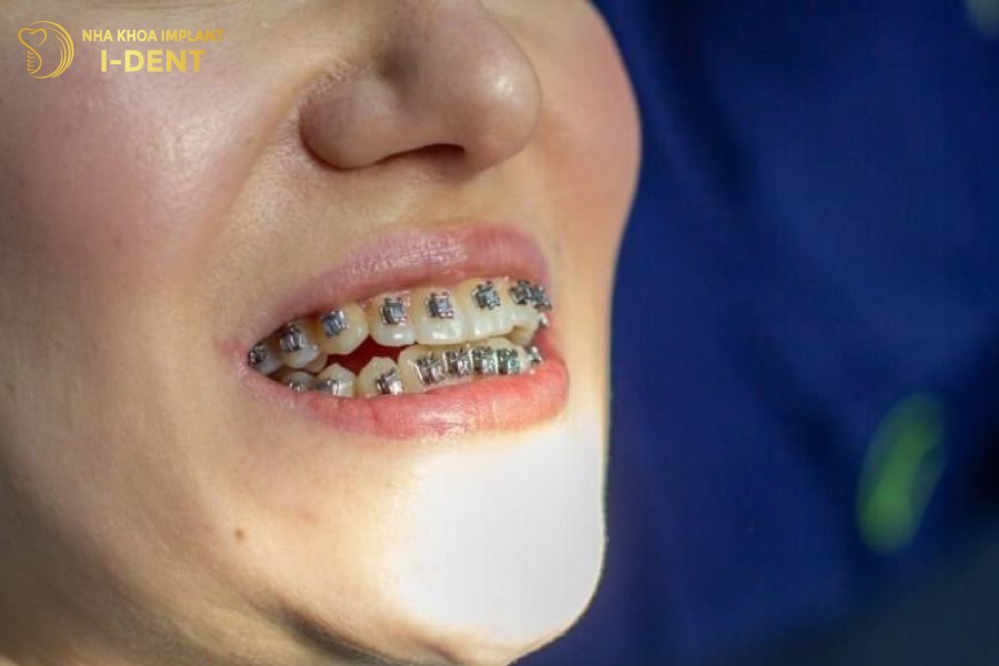 Nguoi-lon-tuoi-co-thoi-gian-nieng-rang-lau-hon