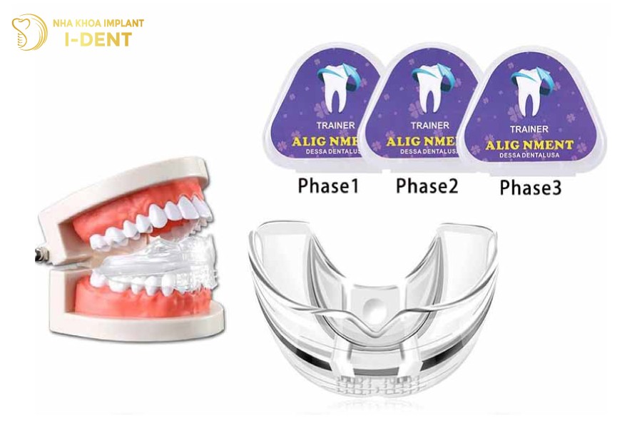 bộ niềng răng tại nhà
