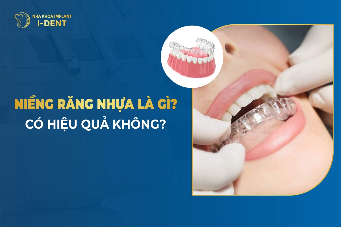 Niềng Răng Nhựa Là Gì? Có Hiệu Quả Không?