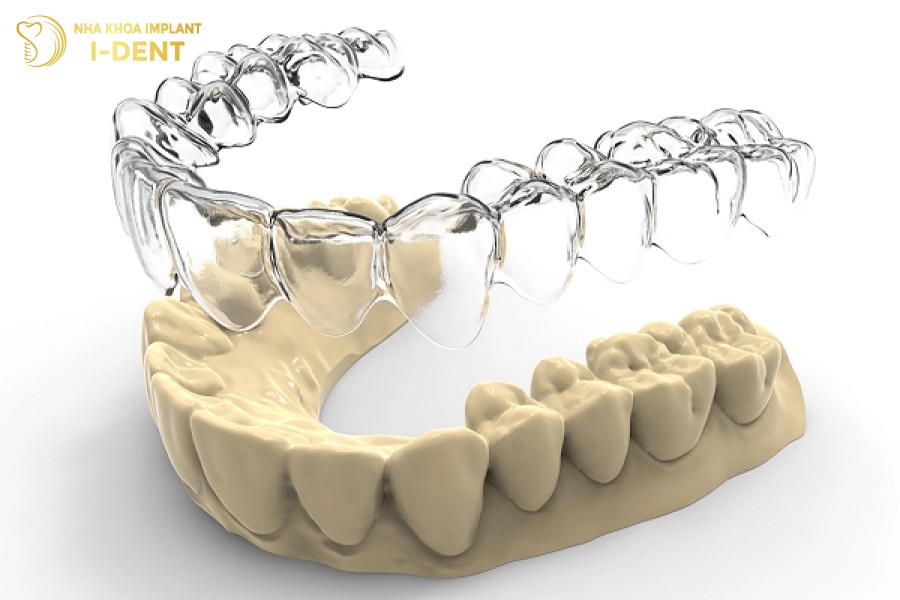 Nieng-rang-khong-mac-cai-3D-clear
