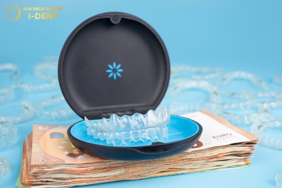 Niềng răng nhựa có chi phí cao nhất trong các phương pháp niềng răng