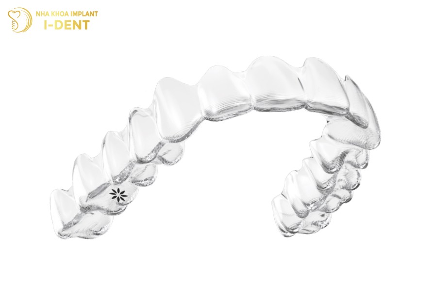 niềng răng tháo lắp mức 1