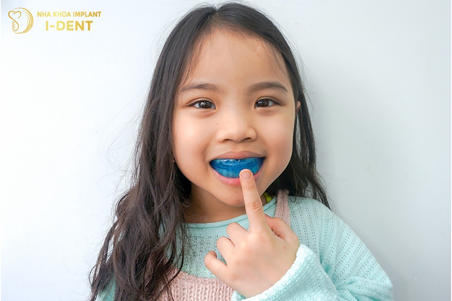 niềng răng tháo lắp trẻ em