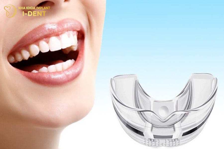 niềng răng silicon trainer