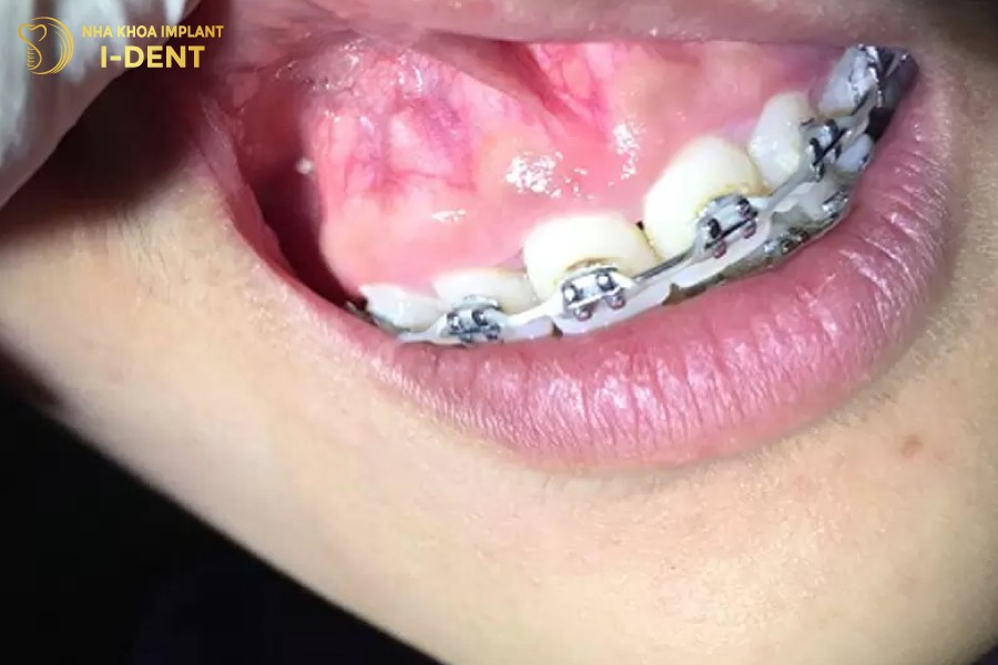 Tay-nghe-bac-si-kem-khien-cho-ket-qua-nieng-rang-khong-the-duy-t