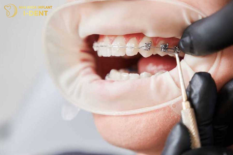 Tay-nghe-bac-si-la-yeu-to-quan-trong-quyet-dinh-ket-qua-nieng-rang