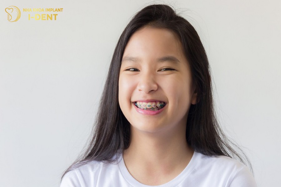 Thoi-gian-nieng-rang-ly-tuong-tu-12-16-tuoi