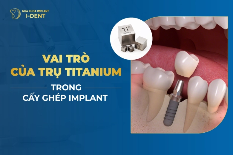 Titanium Là Gì? Những Đặc Tính Ưu Việt Của Titanium