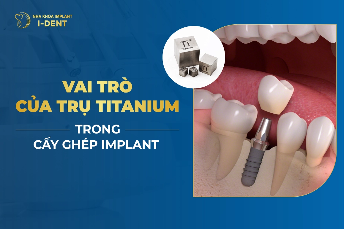 Titanium Là Gì? Những Đặc Tính Ưu Việt Của Titanium