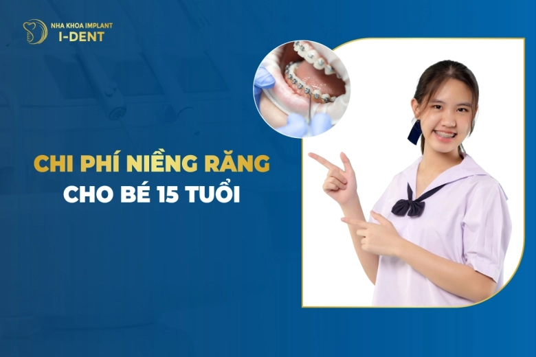 Chi Phí Niềng Răng Cho Bé 15 Tuổi
