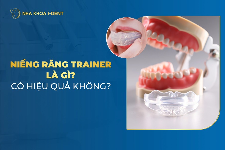 Niềng Răng Trainer Là Gì? Có Hiệu Quả Không?