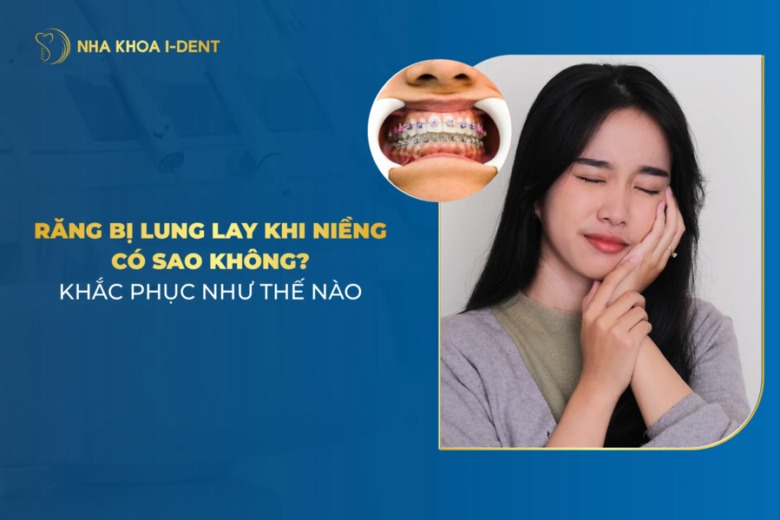 Răng bị lung lay khi niềng: Nguyên nhân và cách khắc phục