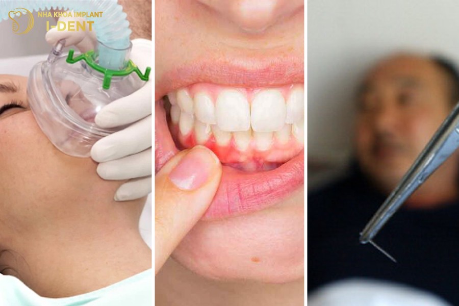 Cac-rui-ro-khi-dieu-tri-tuy-rang-tai-noi-kem-chat-luong