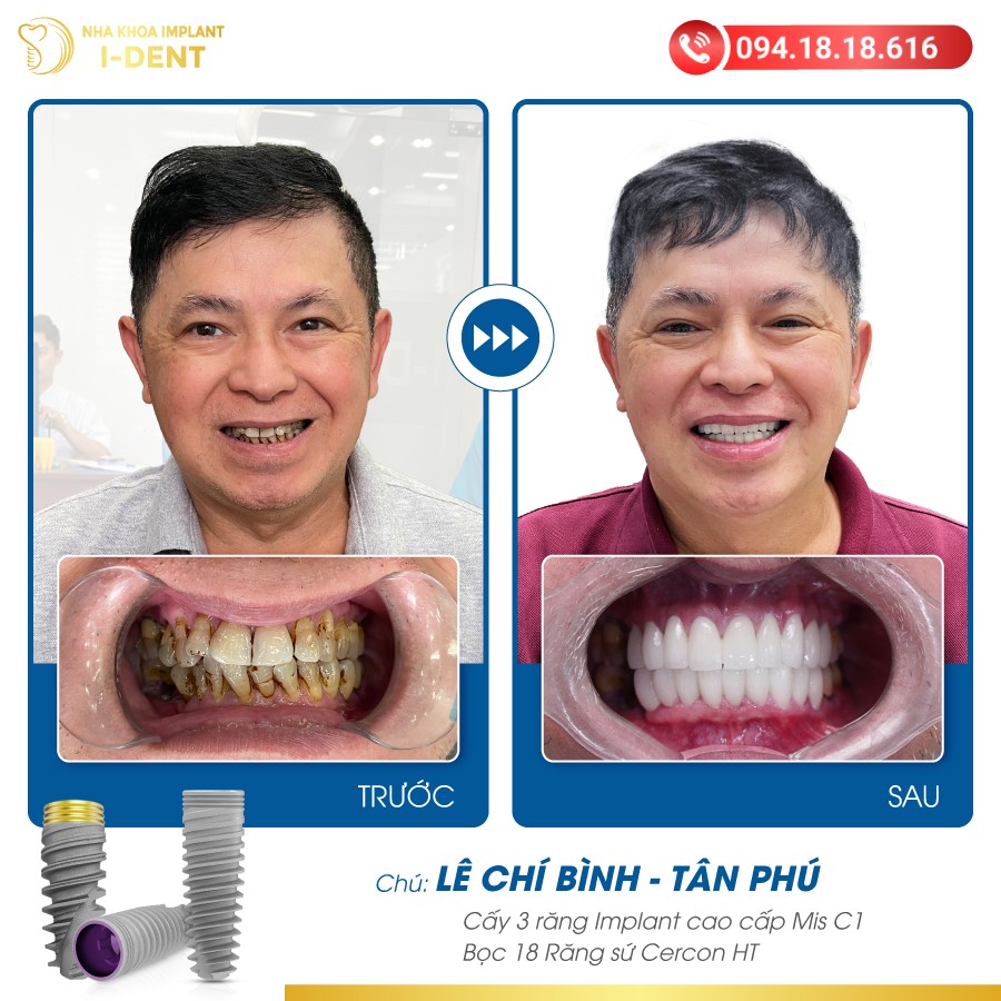 Le-chi-Binh---Tân-Phú