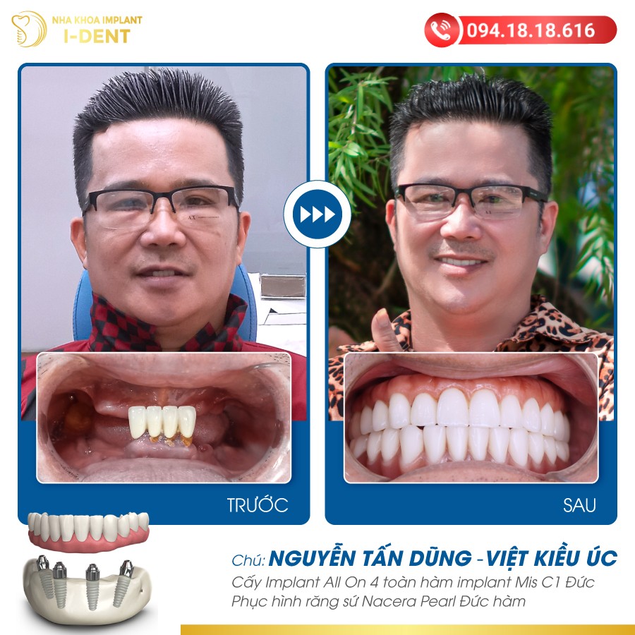 NGUYỄN TẤN DŨNG