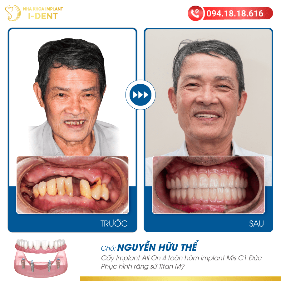 Nguyễn Hữu Thể-01