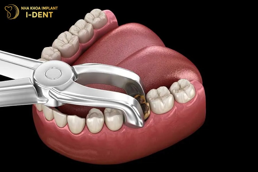 Nho-rang-neu-bi-thung-san-tuy-hoac-chop-tuy