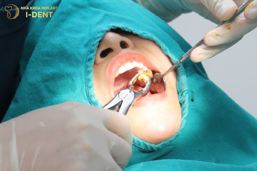 Nho-rang-so-7-trong-cac-tinh-huong-dac-biet