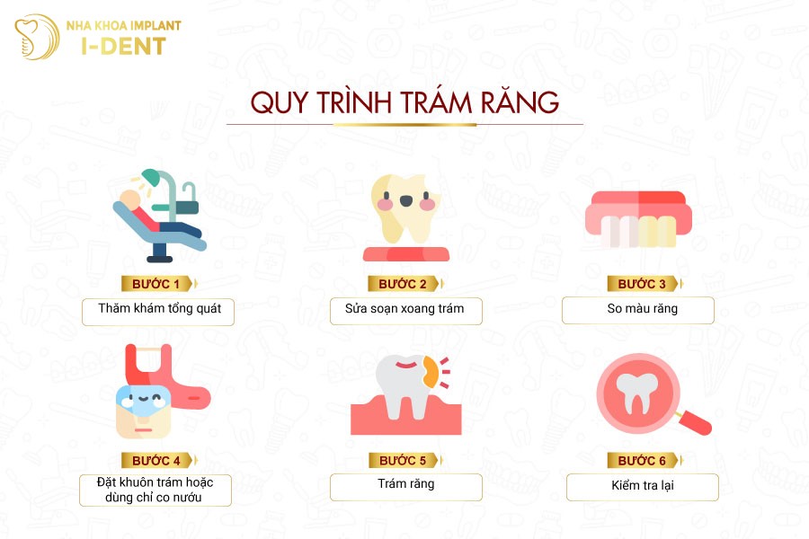 Quy-trinh-tram-rang-tham-my-tai-Nha-khoa-I-Dent