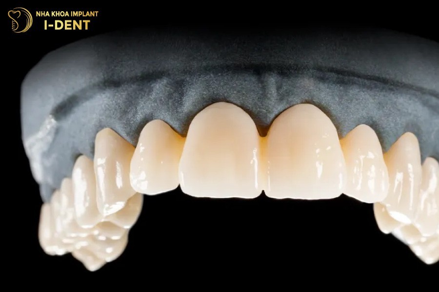 Rang-su-Bio-Esthetic-co-do-trong-tu-nhien