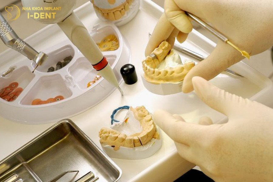 Rang-su-Bio-Esthetic-doi-hoi-cao-ve-ky-thuat