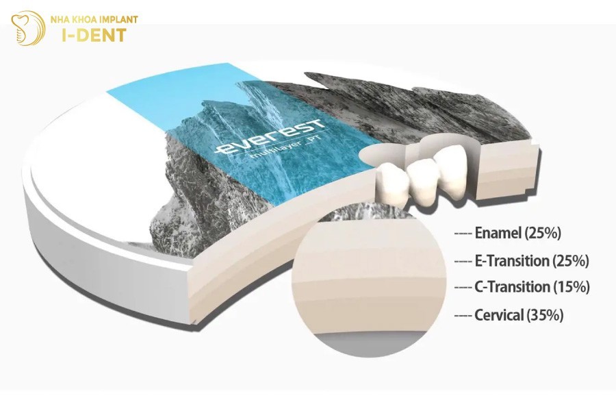 Rang-su-Multilayer-Everest-Speed-chong-nhieu-lop-su-ben-chac