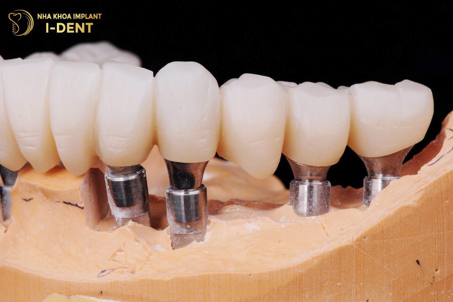 Rang-su-Multilayer-Everest-Speed