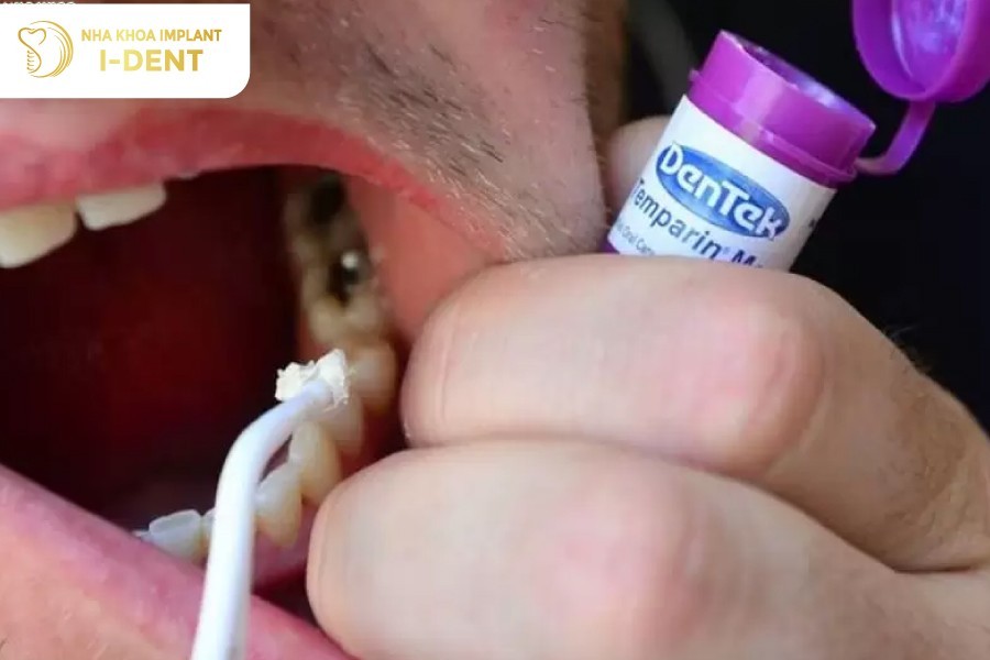 Tram-rang-tai-nha-can-co-su-chuan-bi-ky-luong