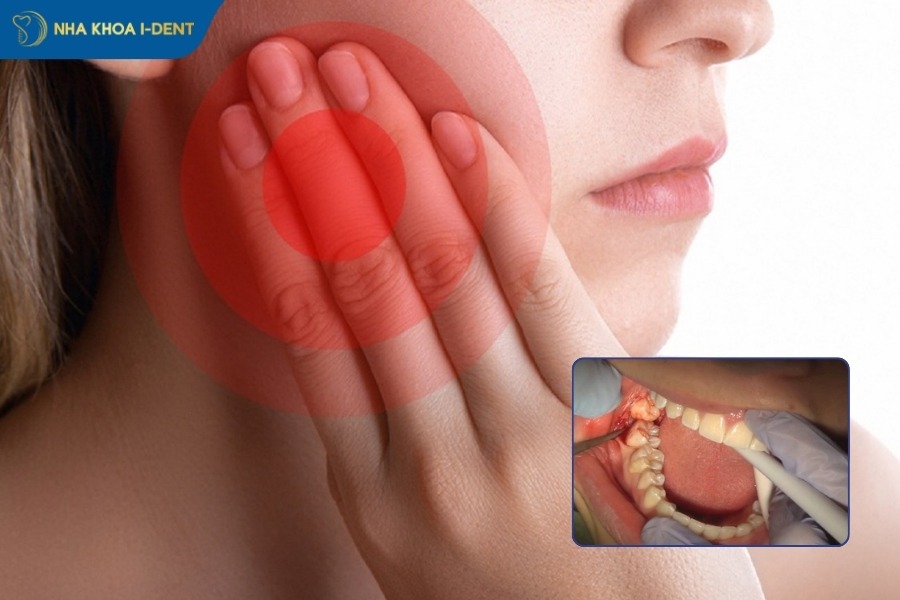 dấu hiệu nhiễm trùng sau khi nhổ răng