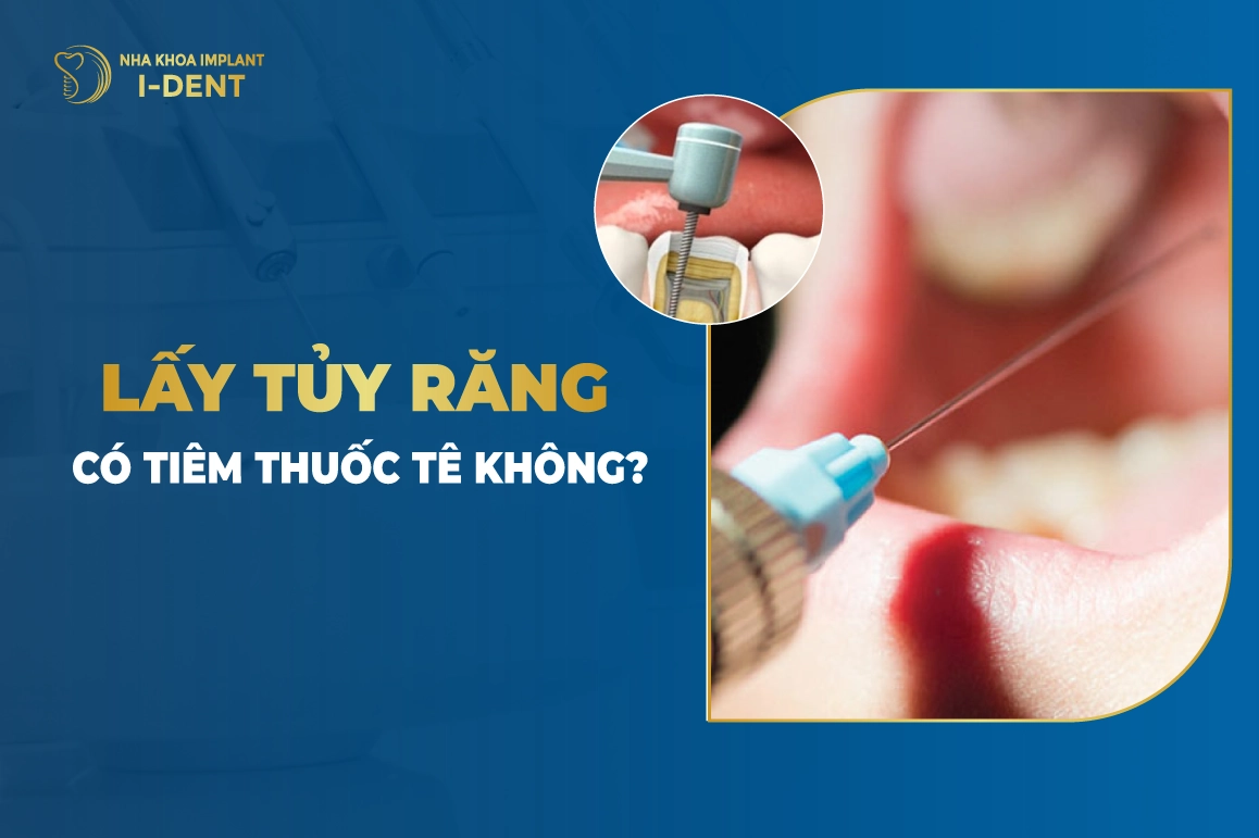 Lấy Tủy Răng Có Tiêm Thuốc Tê Không?