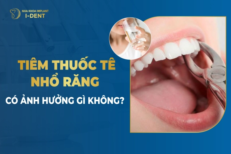 Tiêm Thuốc Tê Nhổ Răng Có Ảnh Hưởng Gì Không? Bao Lâu Hết Tác Dụng?