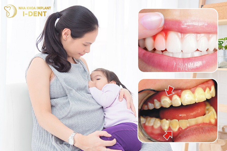 Cac-truong-hop-khong-nen-tay-trang-rang-bang-den-Plasma