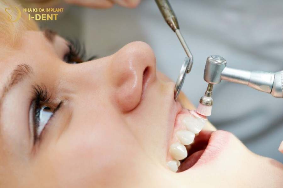 Lam-sach-voi-rang-se-giup-giam-mui-hoi-mieng-kho-chiu