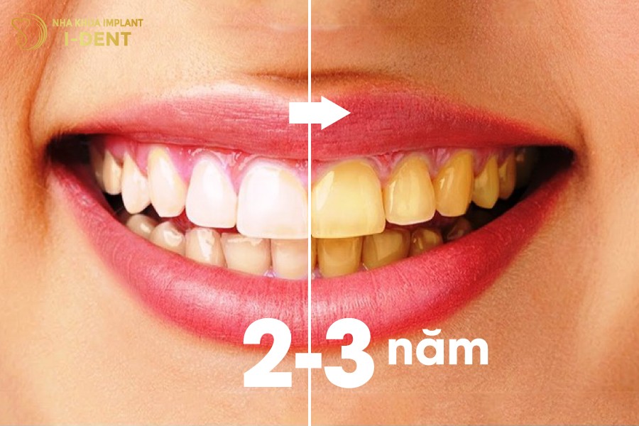 Tay-trang-rang-bi-vang-lai-sau-2-3-nam